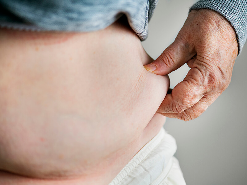 cirujanos bariatricos barranquilla